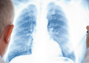 Săptămâna trecută au fost raportate 79.270 de cazuri de infecții respiratorii acute