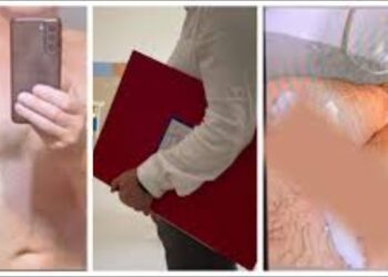 Directorul școlii din Brodina și-a dat demisia după ce imagini cu acesta dezbrăcat au circulat online